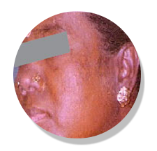 tolenorm ointment after